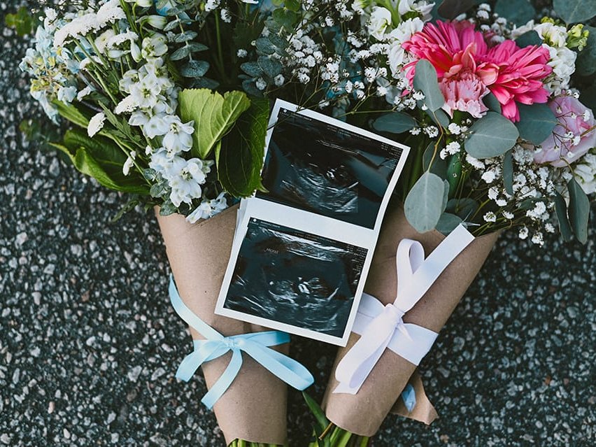Flowers and ultrasound photographs arranged for a pregnancy announcement
